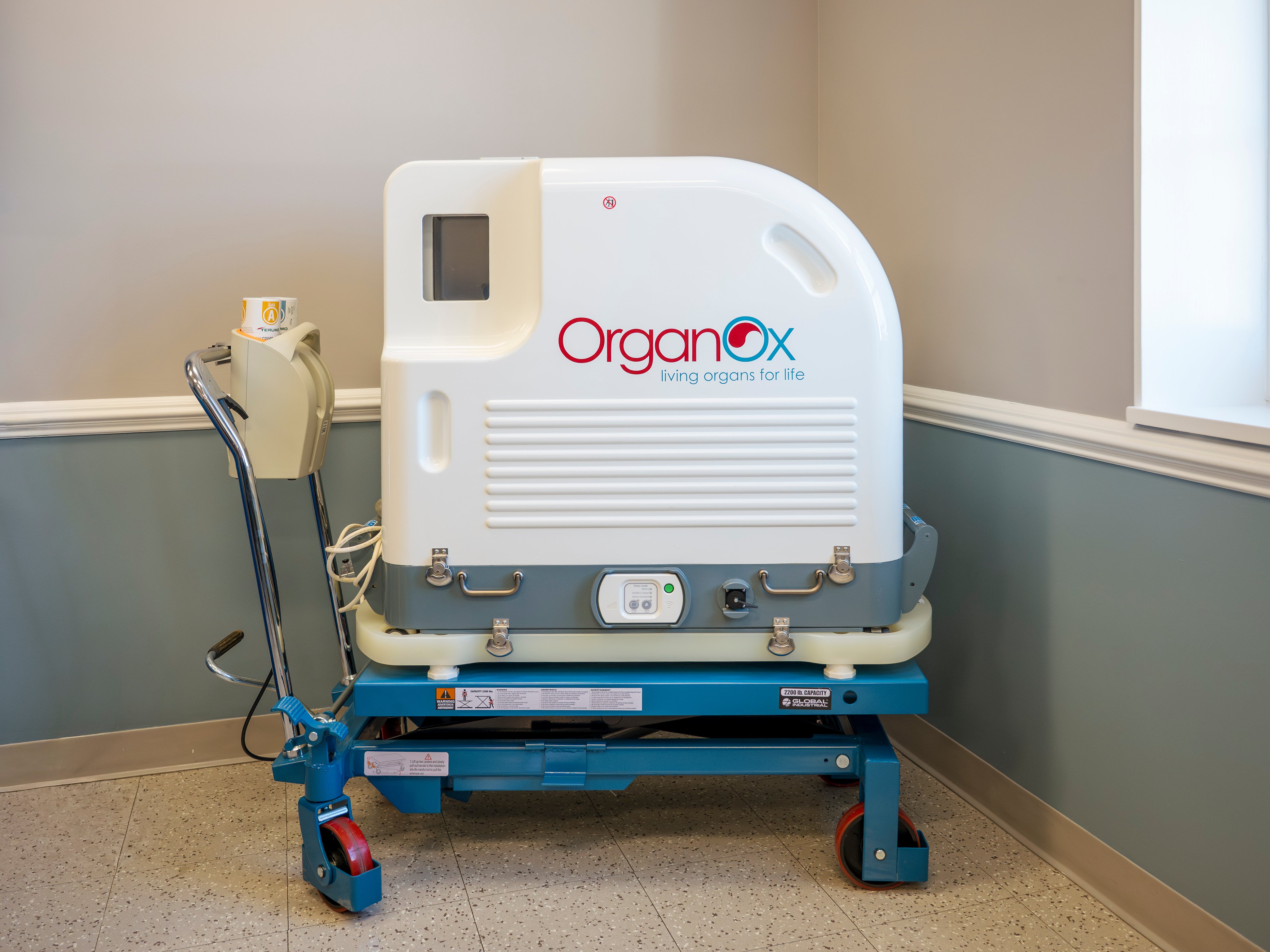 The OrganOx metra is innovative technology for transporting livers for transplant