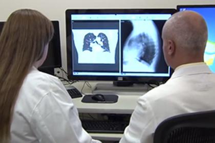2 doctors evaluating images of lungs