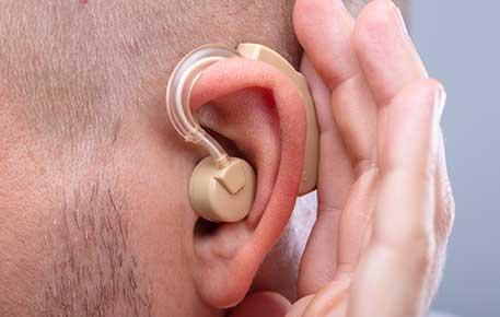 Cochlear implants