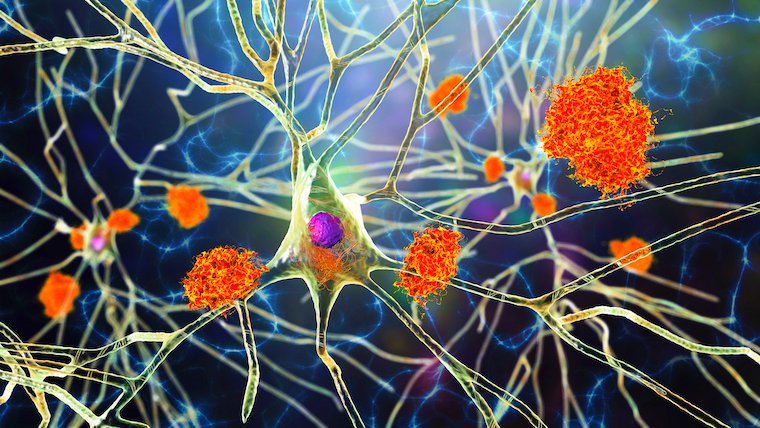 nerve cells