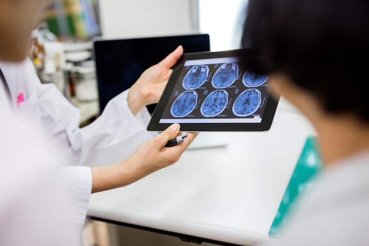 A doctor holds up a tablet with brain imaging visible