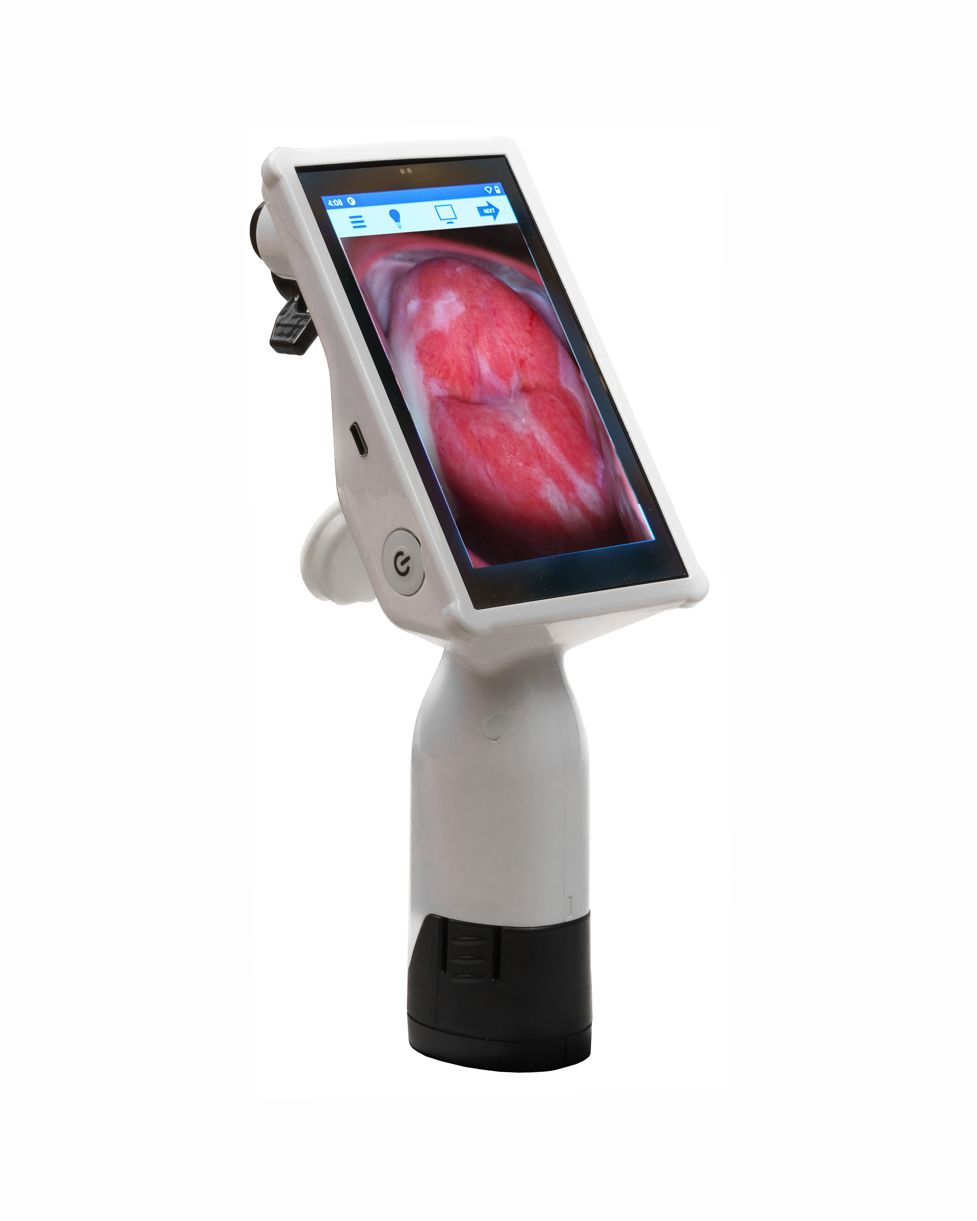 Photo of cervical cancer screening equipment.