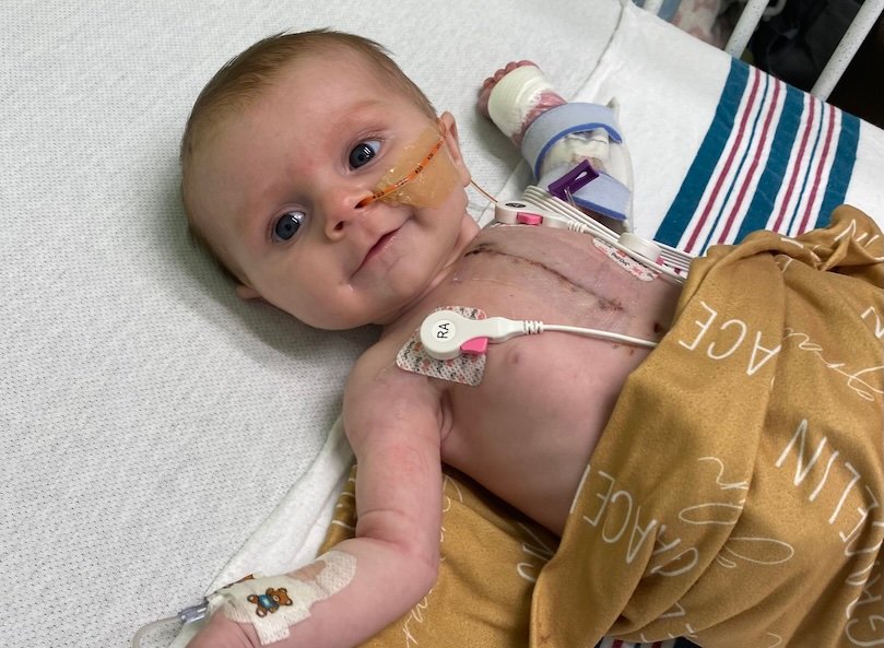 Baby after open heart surgery