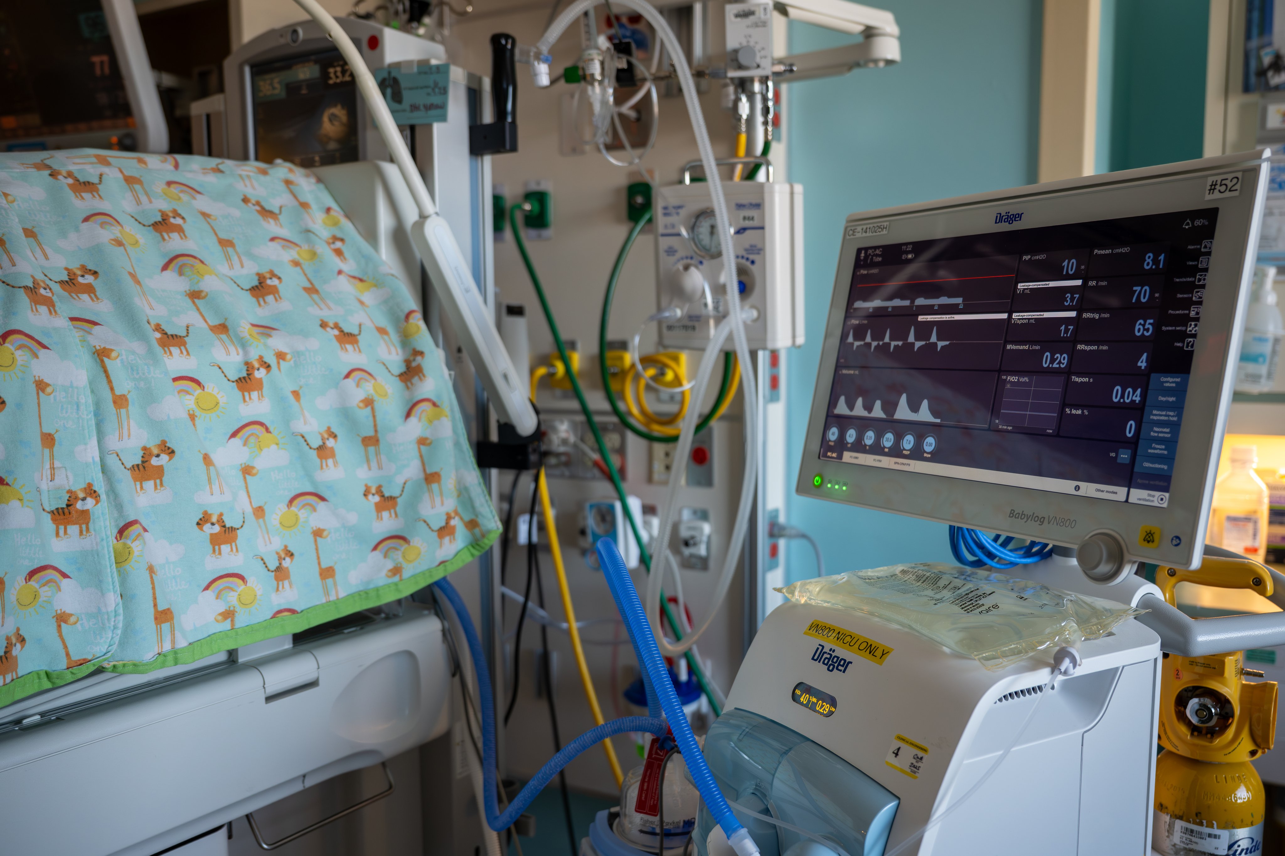 Close-up of NICU bedside shows breathing support settings