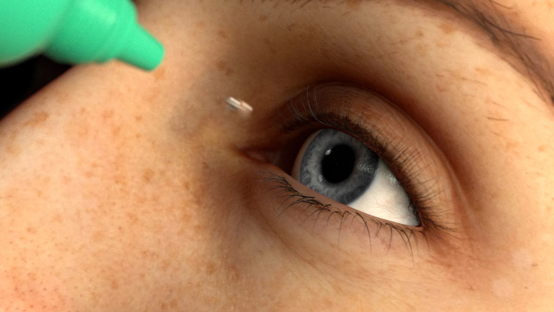 human eye before hfds incision