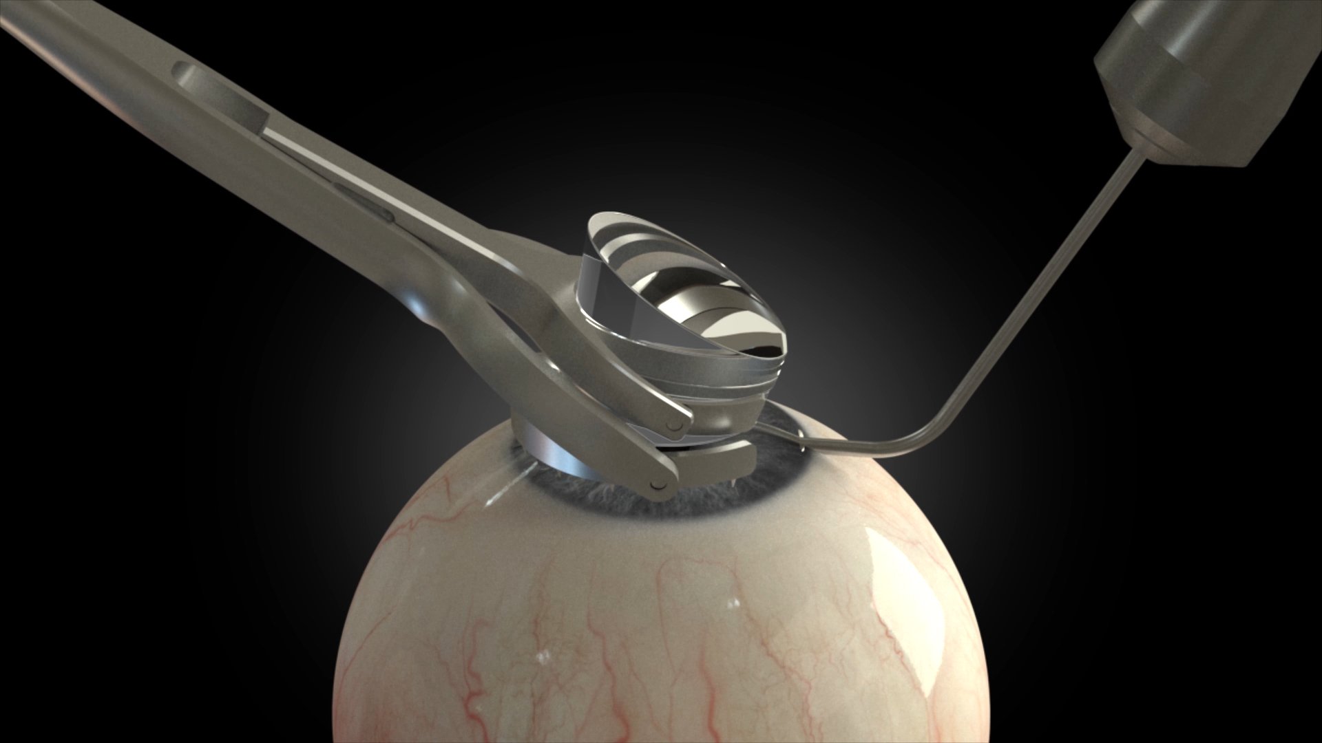 human eye visualisation with hfds positioning