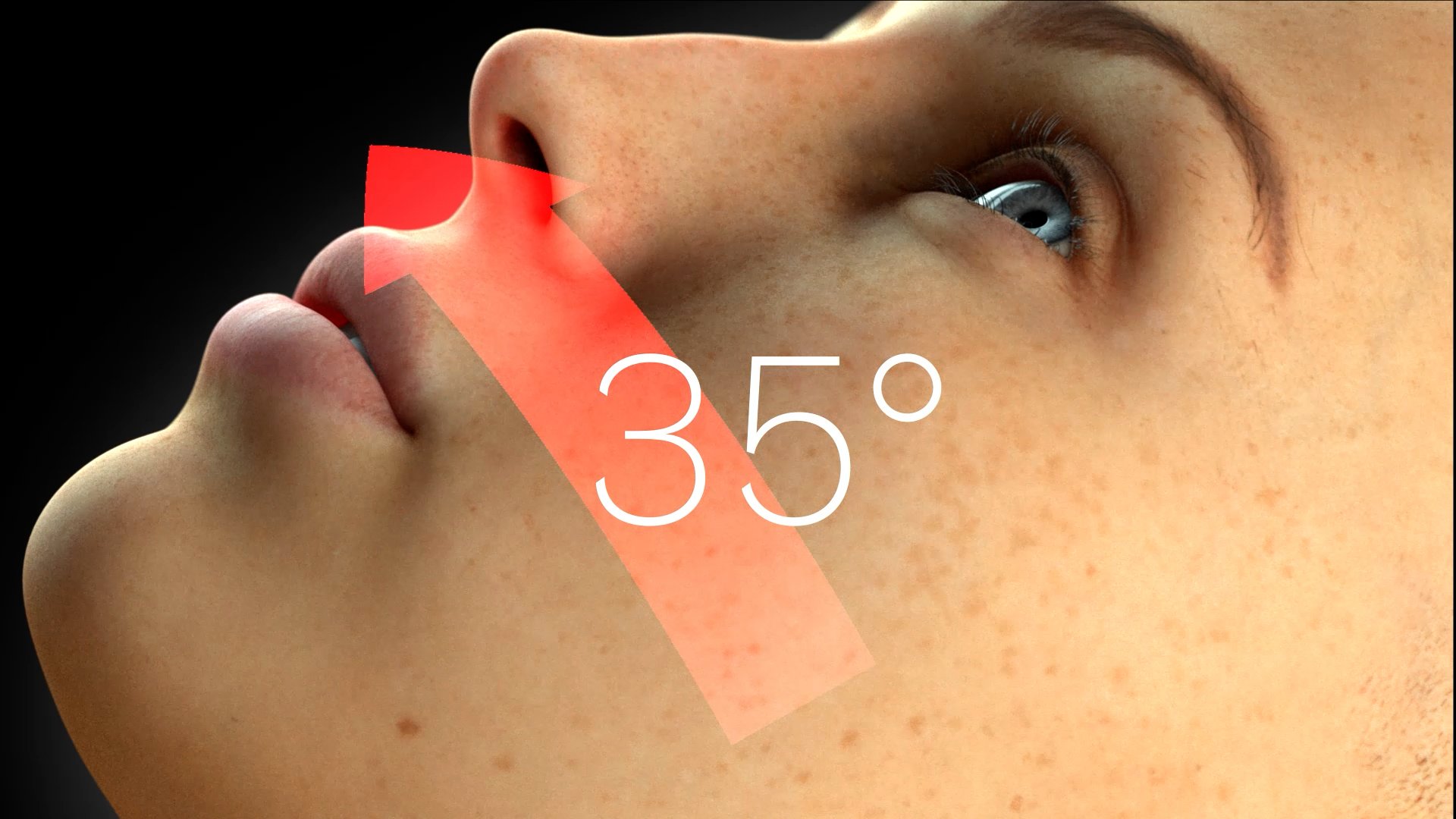 Patient head tilted at 35 degrees with arrow indicating positioning angle for HFDS procedure