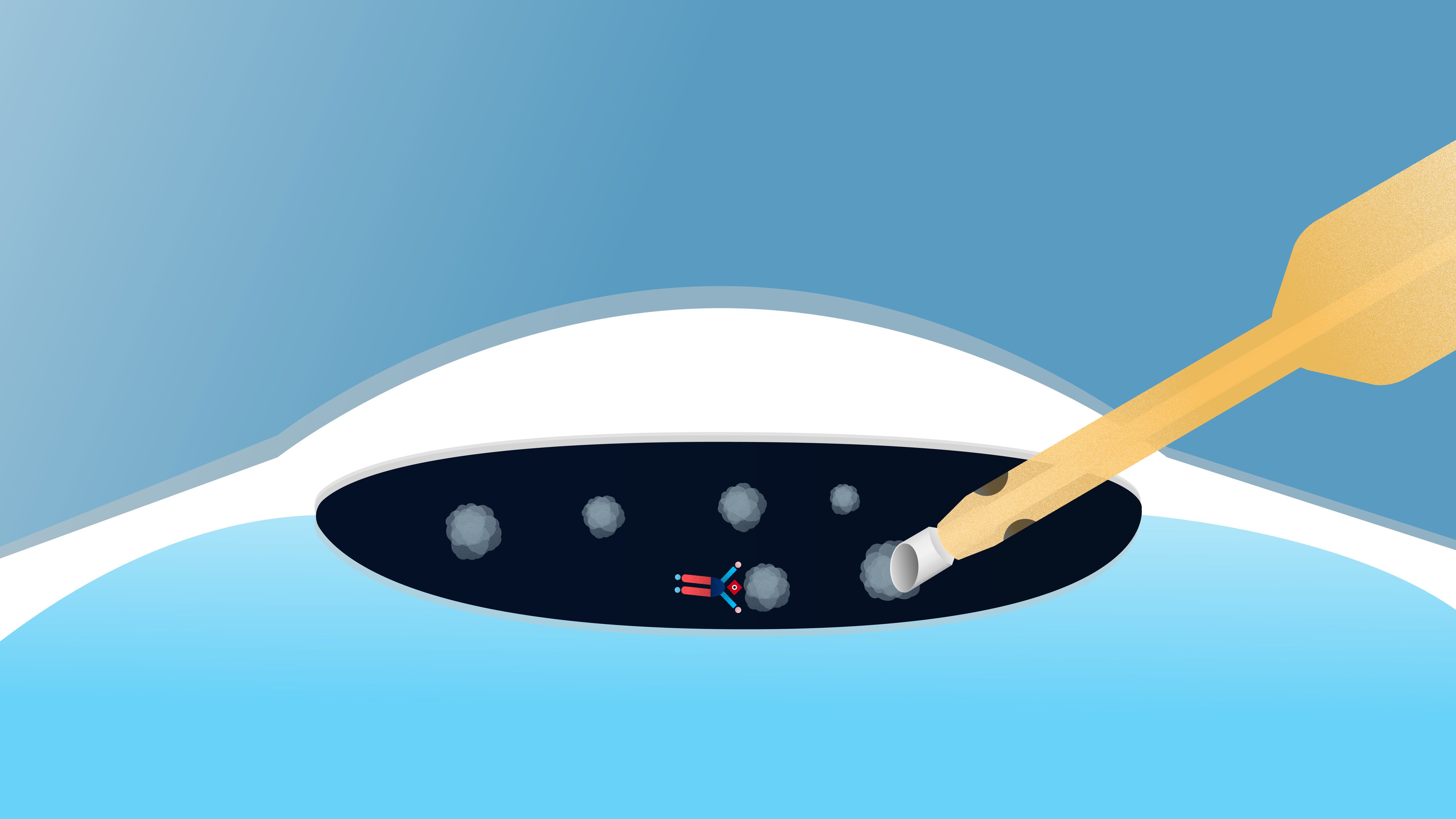 Medical illustration of phacoemulsification during cataract surgery with a surgical tip removing lens fragments inside the eye.