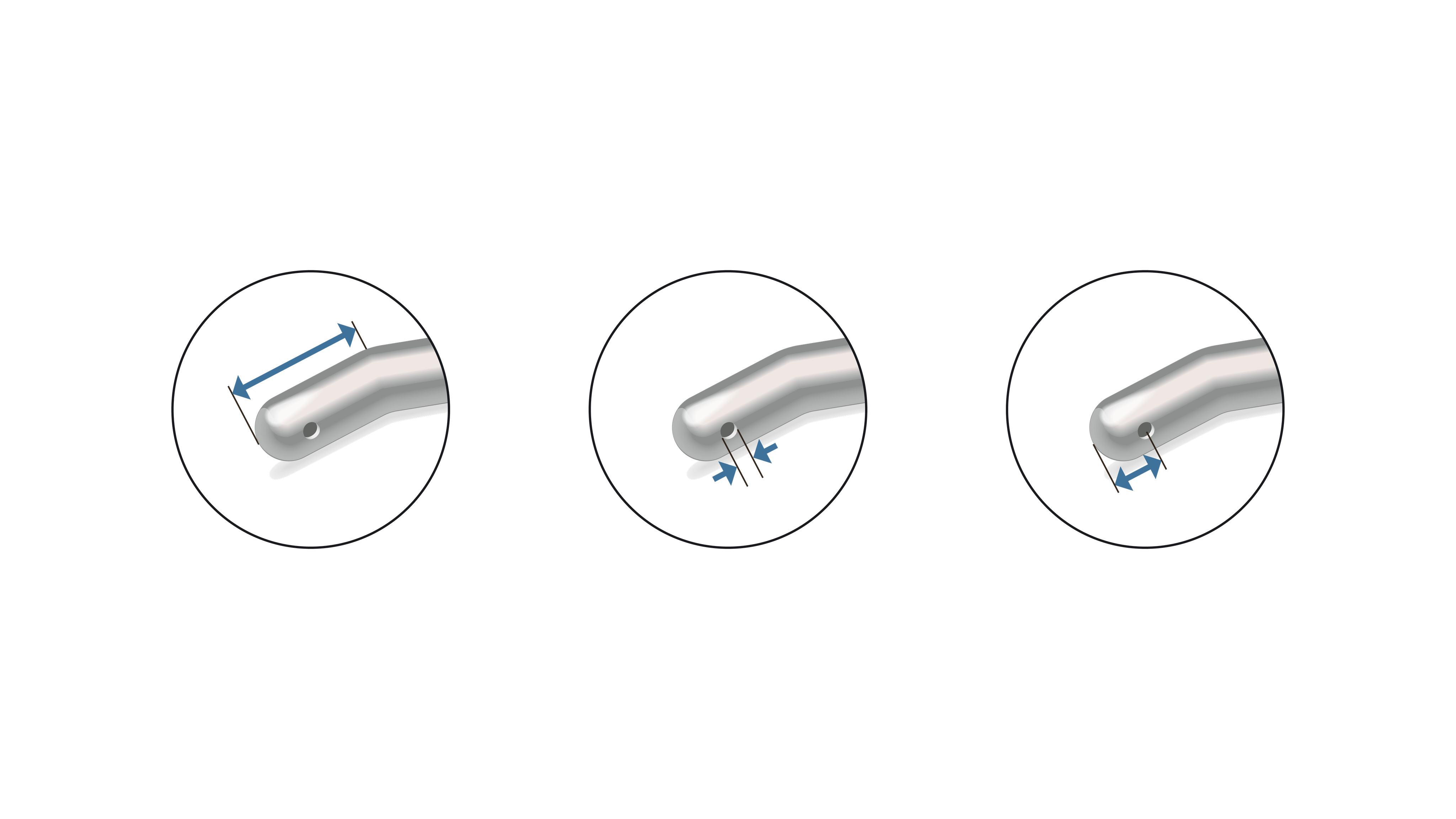 Technical graphic showing three close up views of a curved ophthalmic instrument tip with arrows indicating dimensional and safety design features