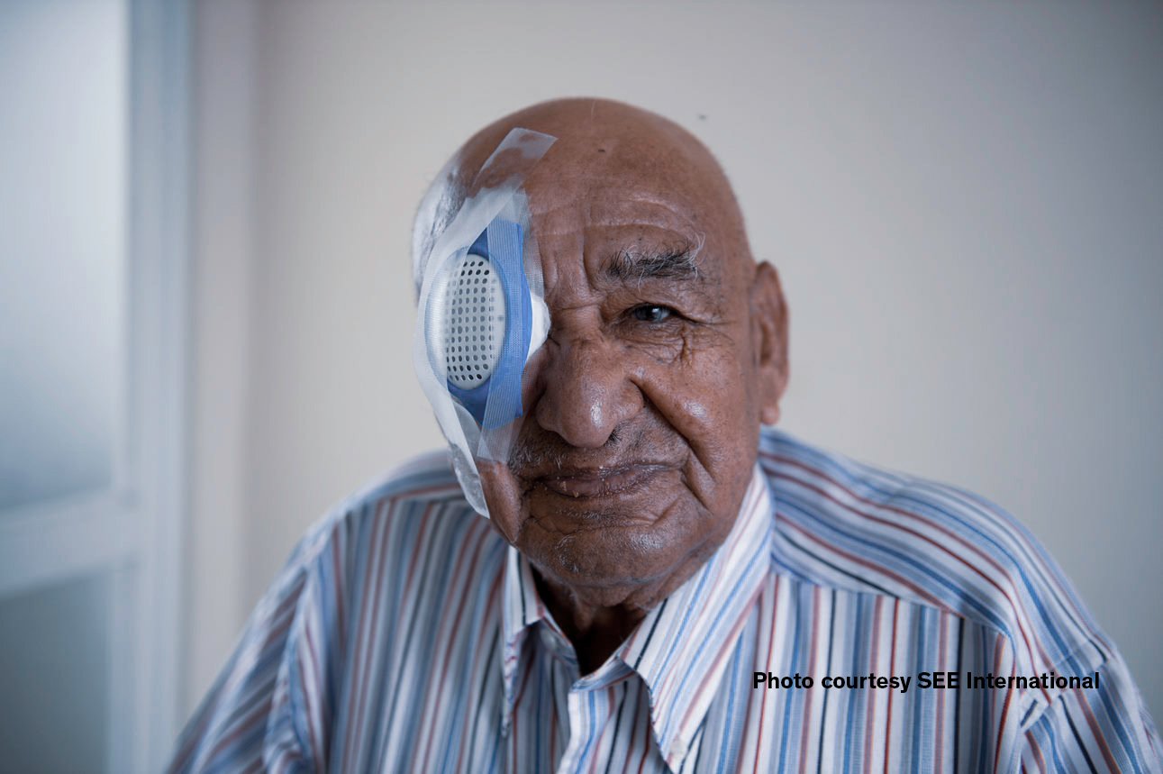 Patient wearing a protective eye shield following eye surgery during postoperative recovery