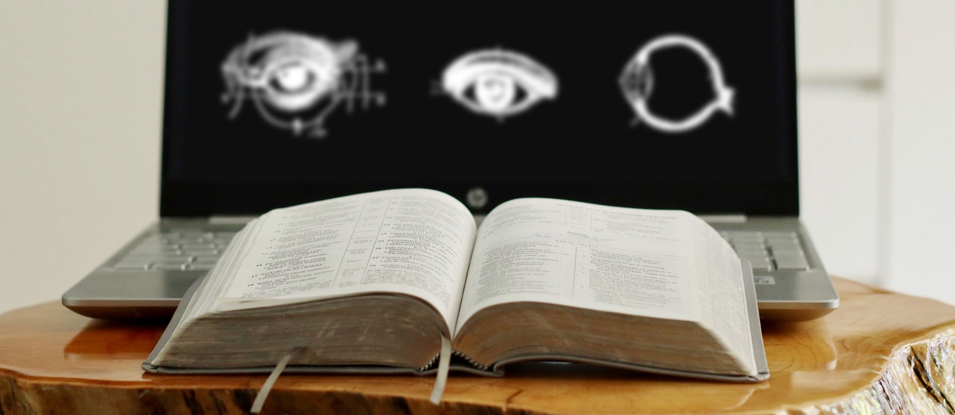Open book in front of a laptop with eye illustrations, symbolising study, knowledge and reflection in eye surgery