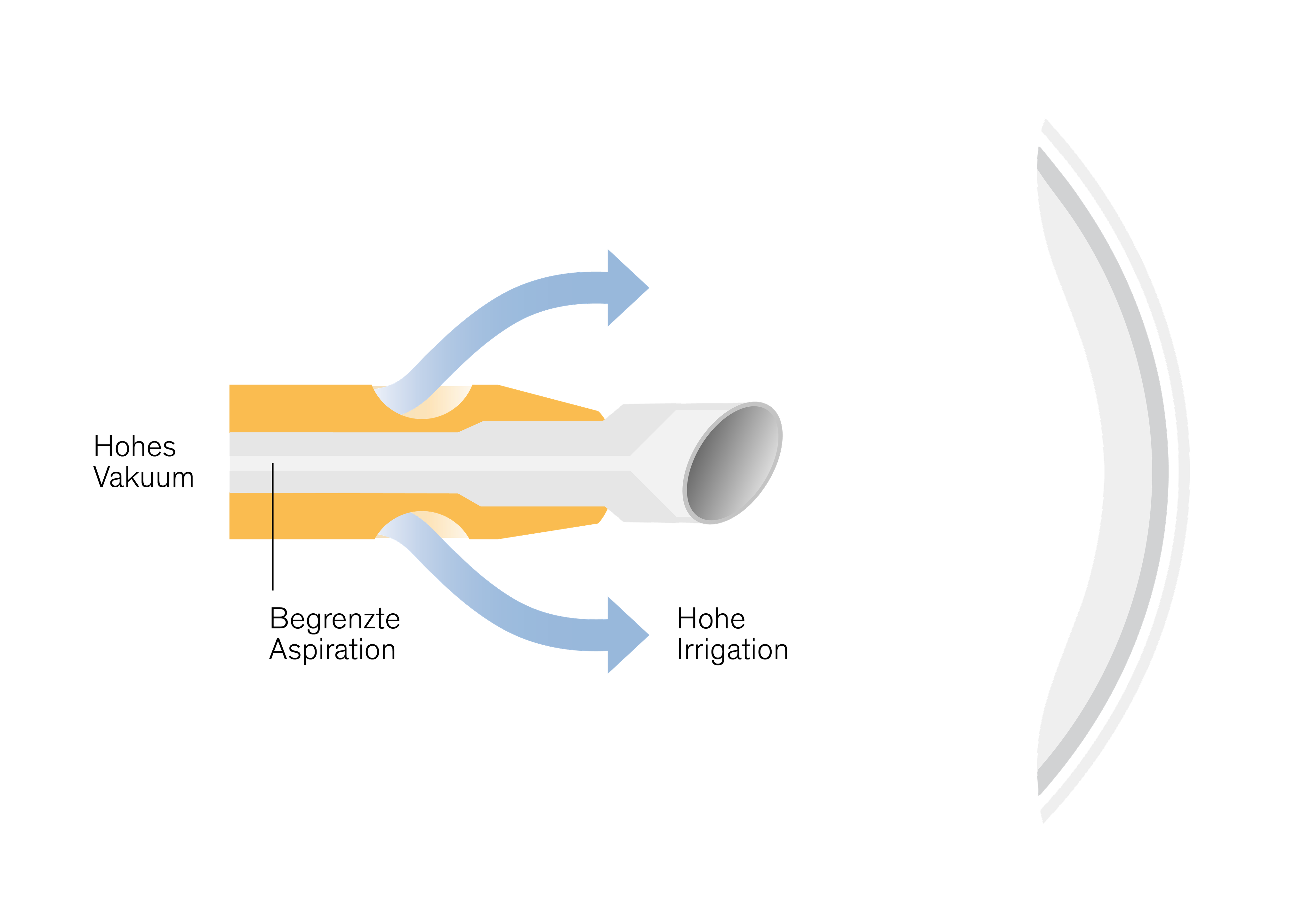 EasyPhaco graphic showing strong vacuum, limited aspiration and high irrigation at the phaco tip
