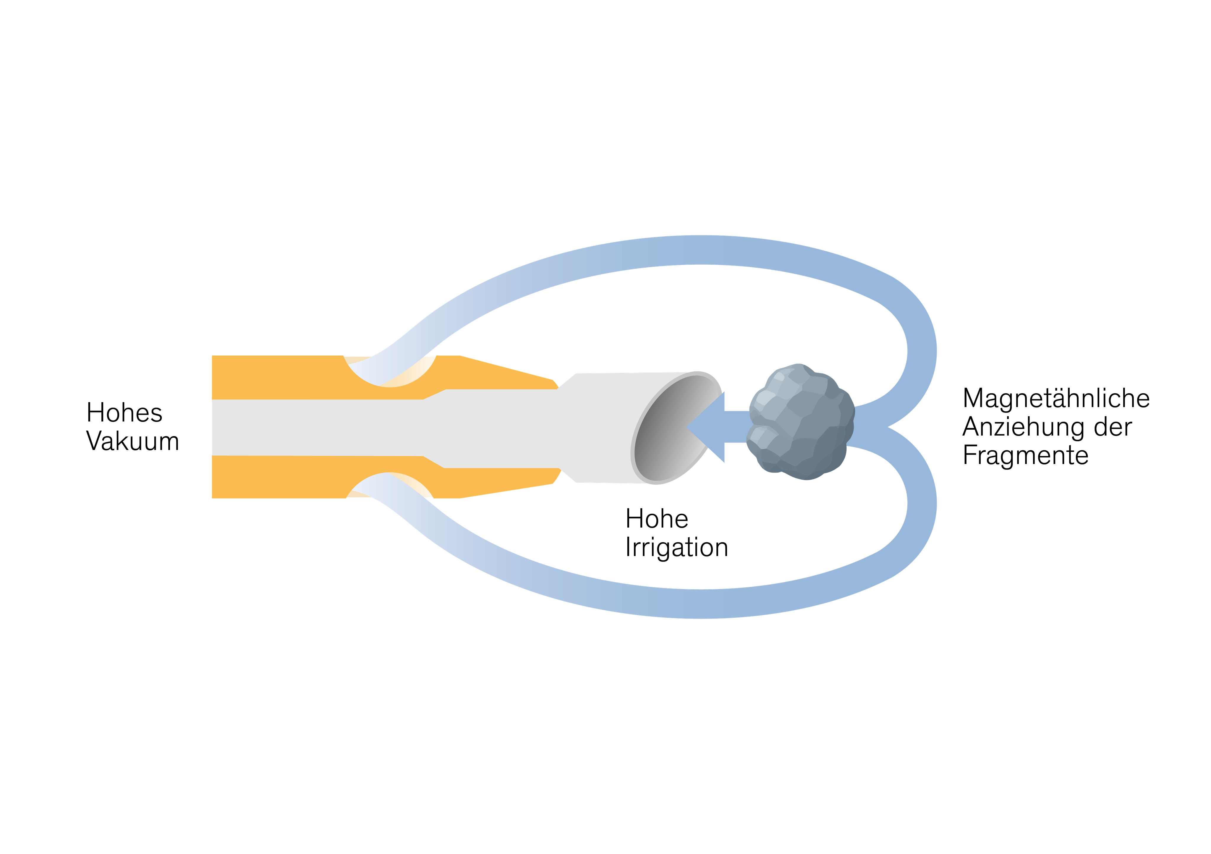 EasyPhaco graphic showing strong vacuum and high irrigation creating magnet-like attraction of fragments at the phaco tip