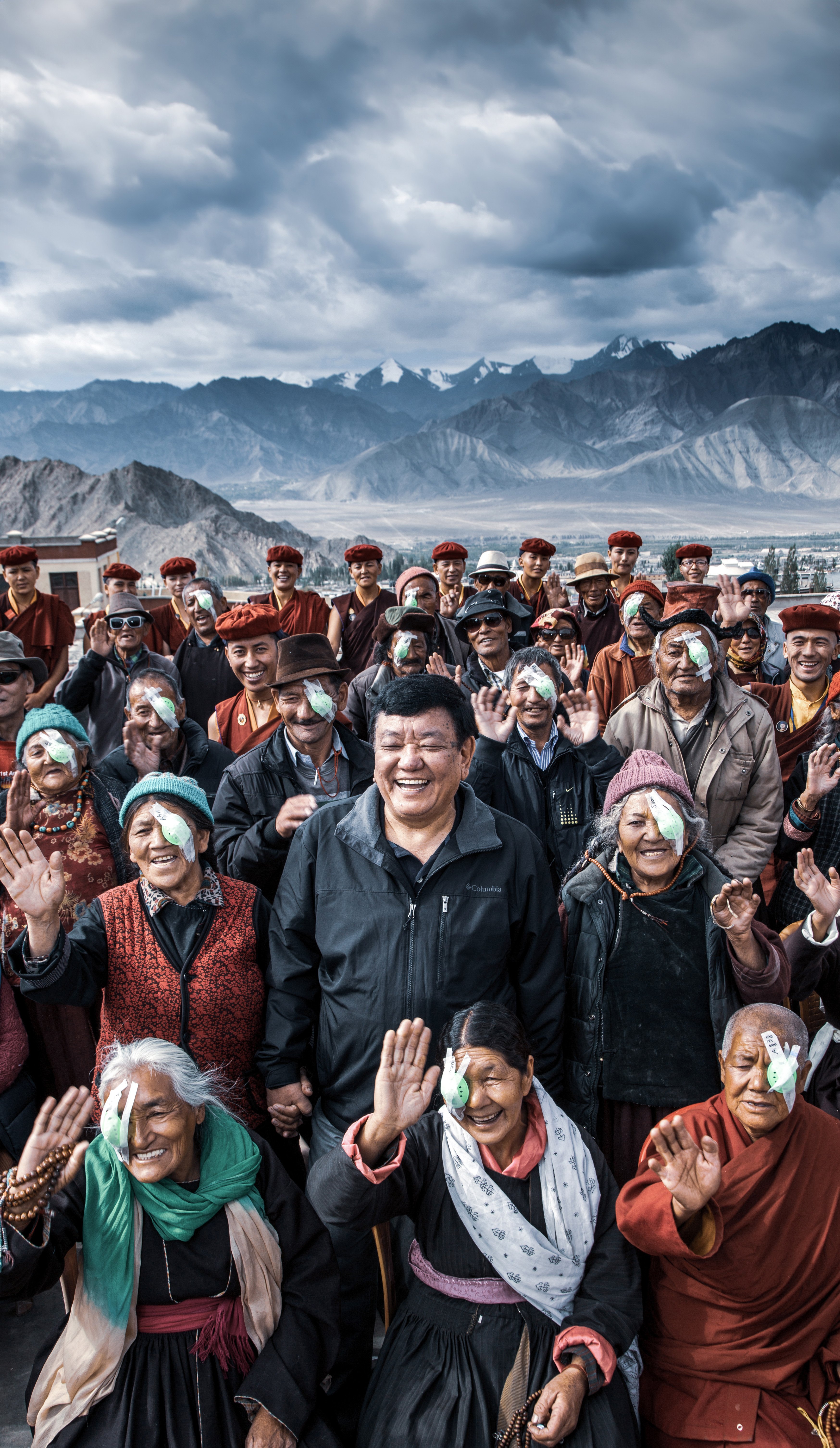 Group of people with eye patches after cataract surgery in a mountainous region by charity project