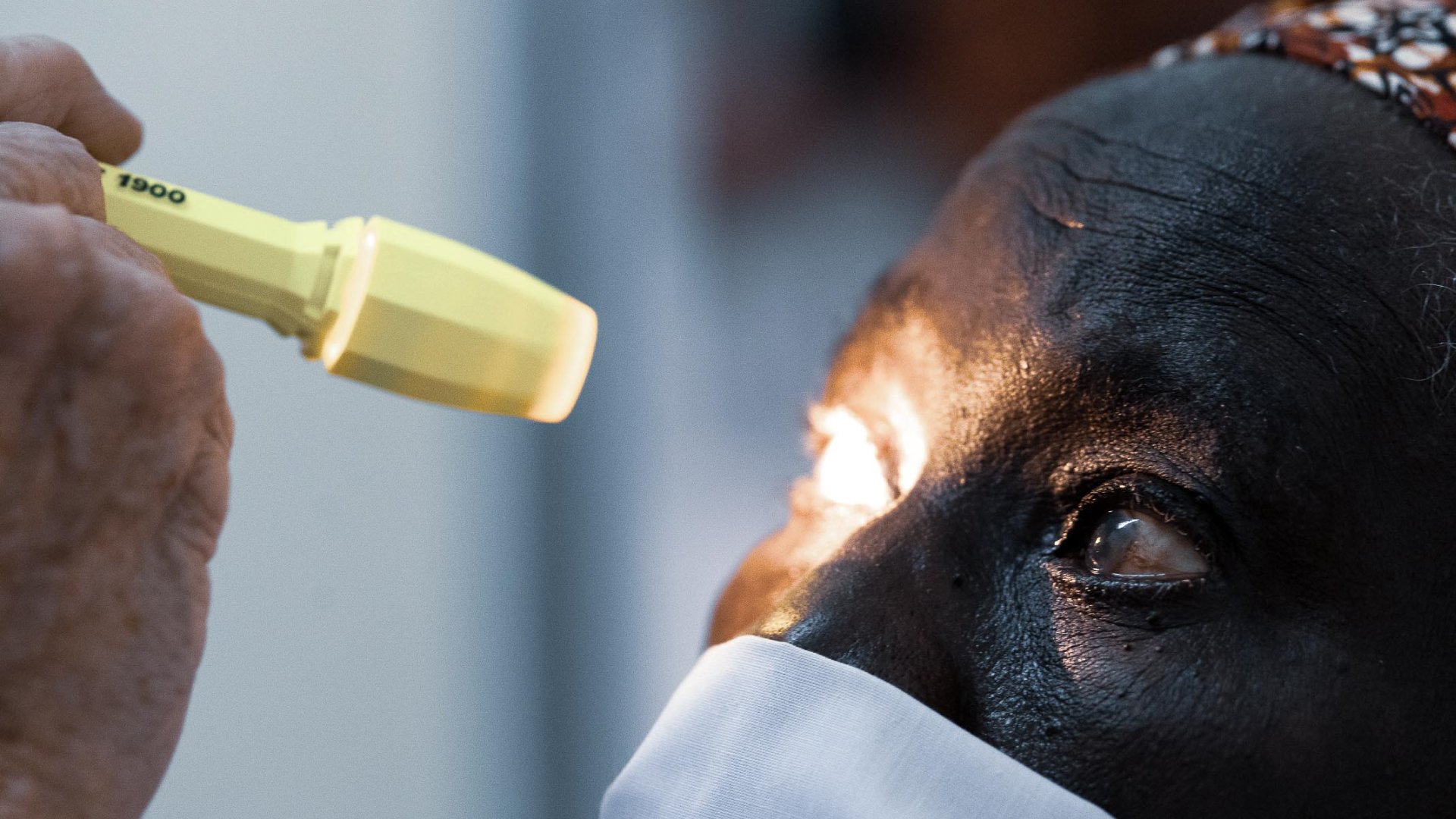Close-up of a patient’s eye being examined with a handheld light during a Fundación Elena Barraquer outreach mission