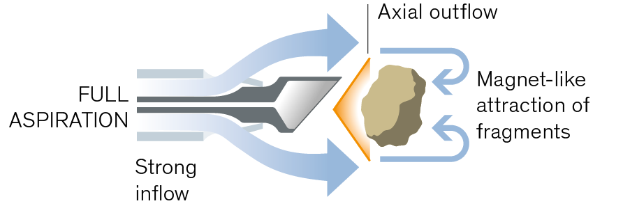 graphic of the functional flow how easyphaco with full aspiration works