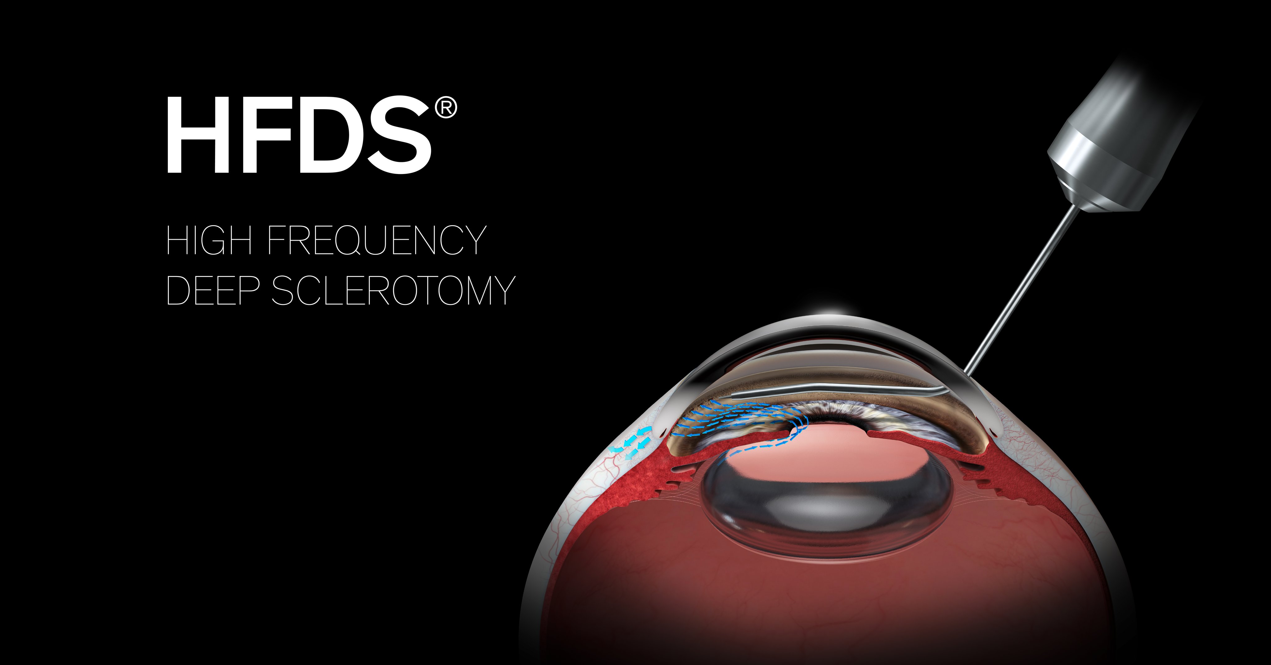 HFDS key visual with human eye visualisation