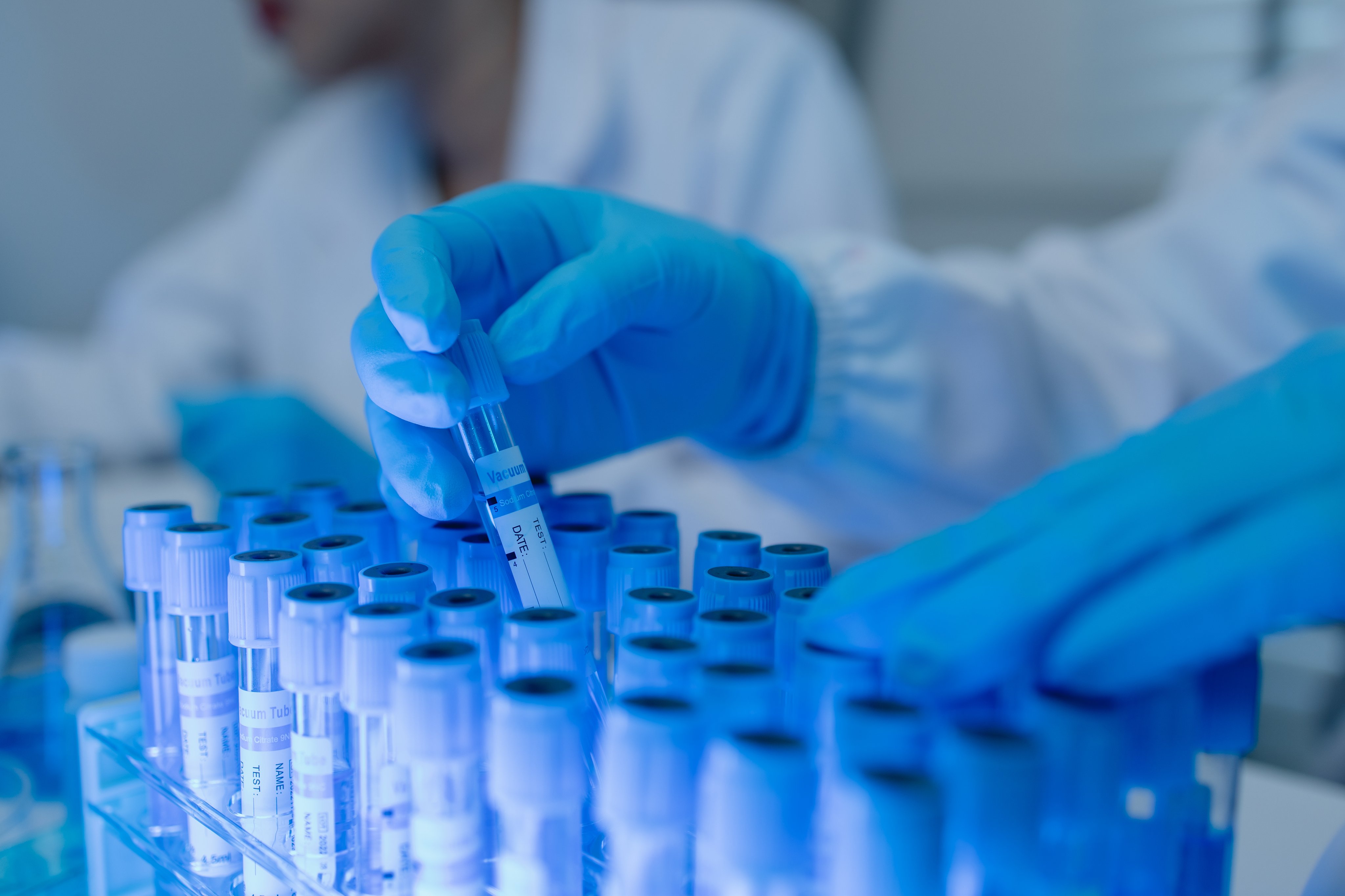a female chemist is testing various liquid compounds in a lab, a scientist is doing research on the development, she wears a lab coat when she works in laboratory, test tube, scientific equipment